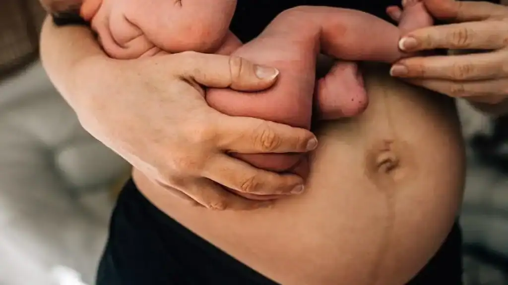 Why Is My Stomach Still Big After Pregnancy Ashbourne?